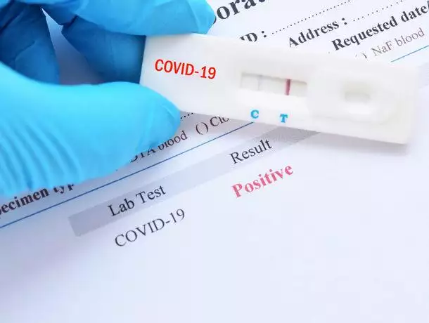 В Молдове подтвердили 256 новых случаев коронавируса