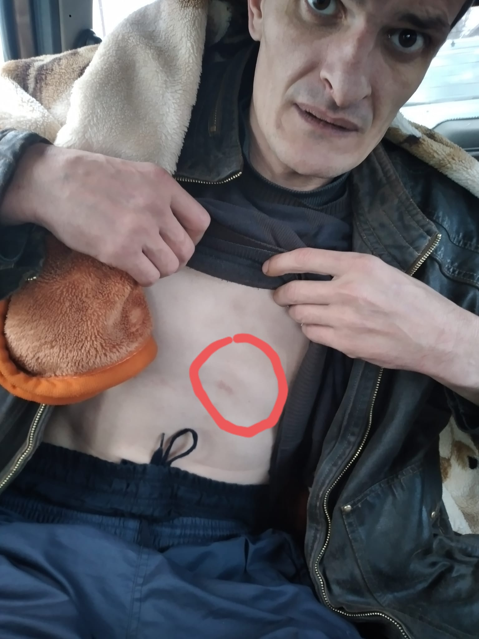 Гражданского активиста избили сотрудники ЧОП, а БСМП отказали в медпомощи (Видео 18+)