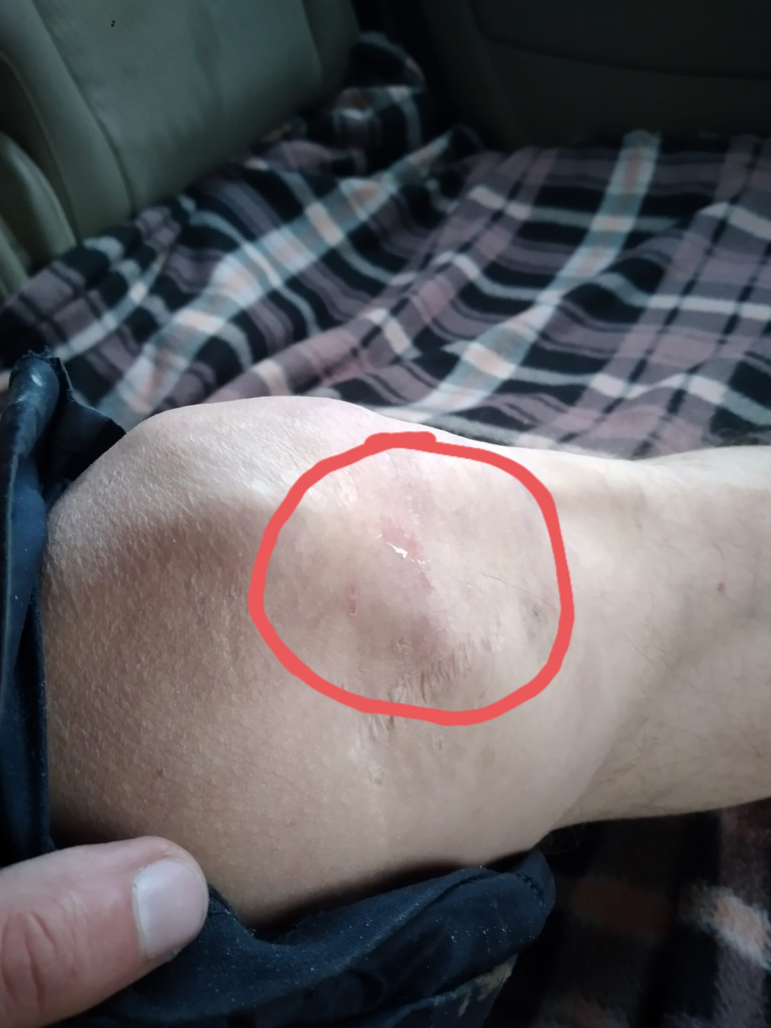 Гражданского активиста избили сотрудники ЧОП, а БСМП отказали в медпомощи (Видео 18+)